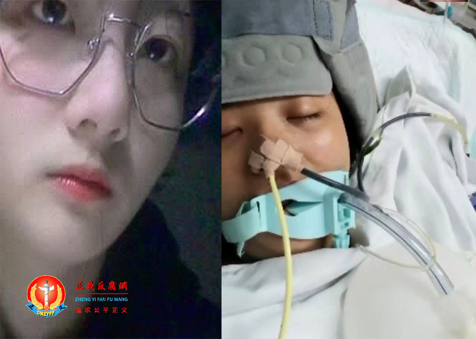15岁女学生冯梦希生前生活照和在涪陵中心医院抢救的照片。.png 15岁女学生冯梦希生前生活照和在涪陵中心医院抢救的照片。.png