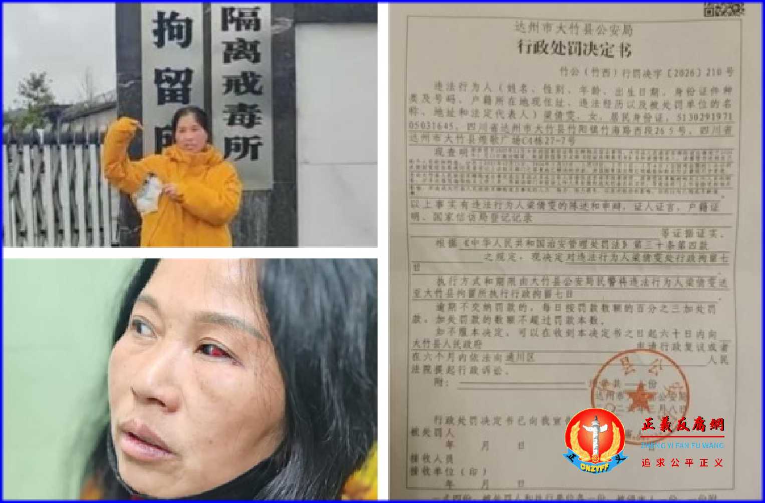 四川访民梁倩雯于2026年全国两会期间遭绑架殴打后报警反被被拘留7日。.jpg 四川访民梁倩雯于2026年全国两会期间遭绑架殴打后报警反被被拘留7日。.jpg